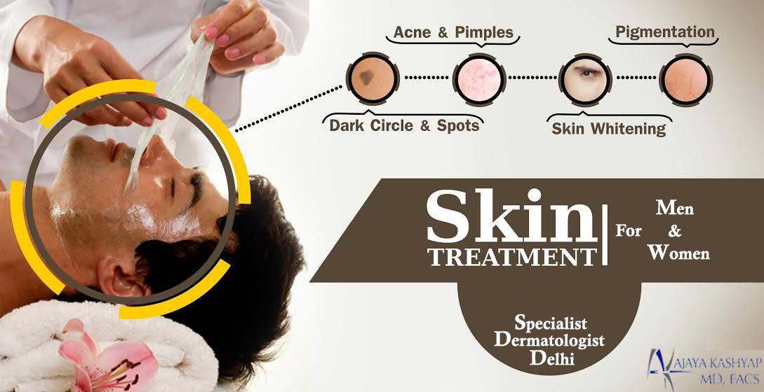 Non-Surgical Treatment in Delhi – Get Set Go to Achieve Improved ...